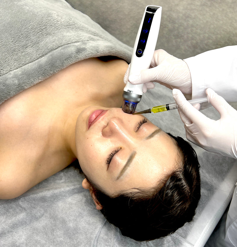 レモンボトル(10ml×5バイアル)(脂肪分解剤)